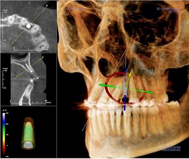 CBCT · TAC de última generación