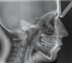 Telerradiografía