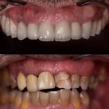 images 2